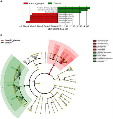 Mediation effect of gut microbiota on the relationship between physical activity and carotid plaque